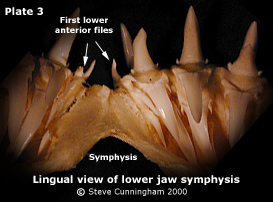 Lingual view of lower jaw symphysis